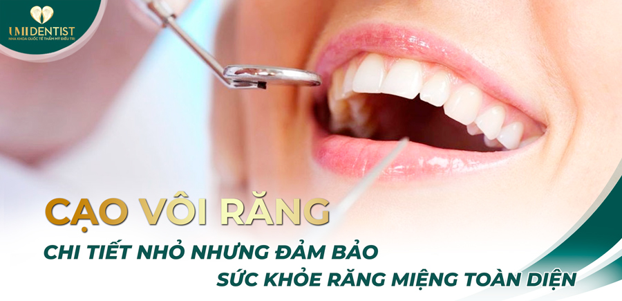 cao-voi-rang-chi-tiet-nho-nhung-dam-bao-suc-khoe-rang-mieng-toan-dien-banner