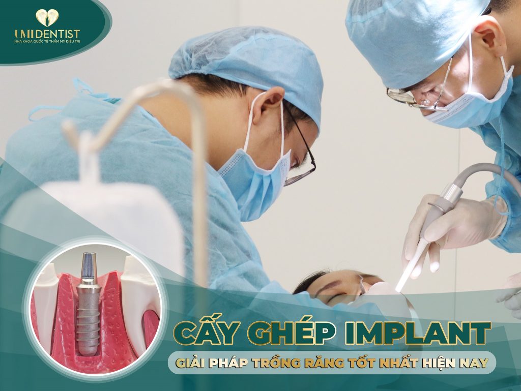 cay-ghep-implant-nguyen-ham-cong-nghe-moi-nhat-1