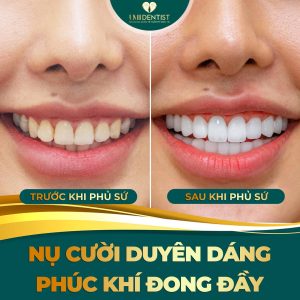 phuong-phap-tham-my-nao-lam-duoc-tuong-rang-phu-quy-2